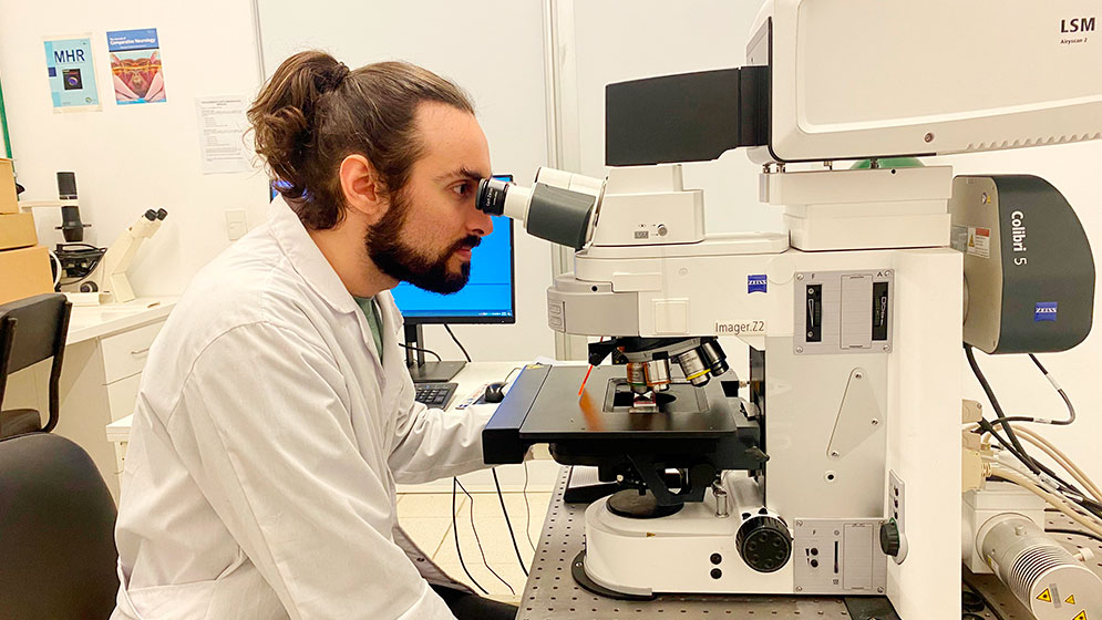 Diabetes tipo 1: nuevo hallazgo para generar células beta productoras de insulina con fines terapéuticos