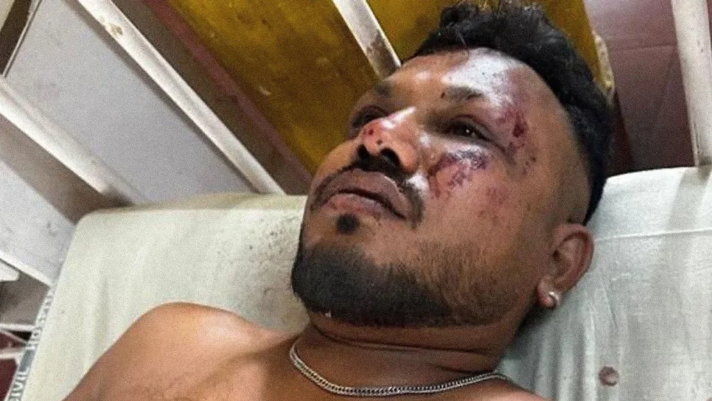 Ramesh Viswashkumar viajaba en el avión de India Air y vivió para contarlo: «Pensé que yo también iba a morir”